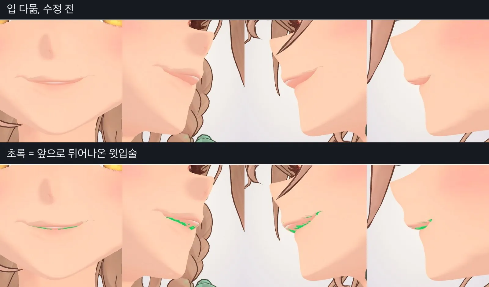 옆에서만 보이는 윗입술의 돌출